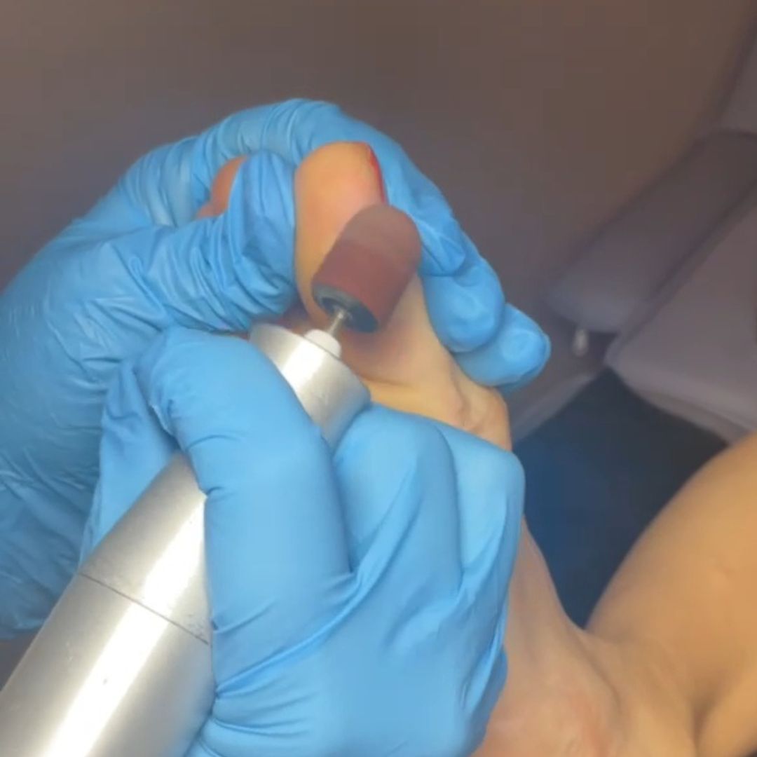 dry pedi
